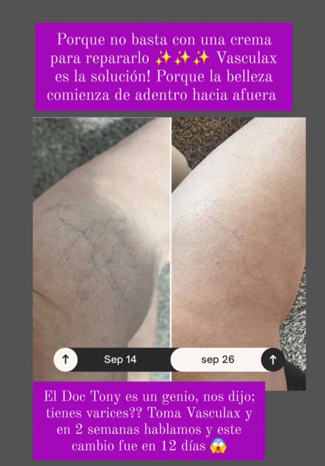 Antes y después 12 días