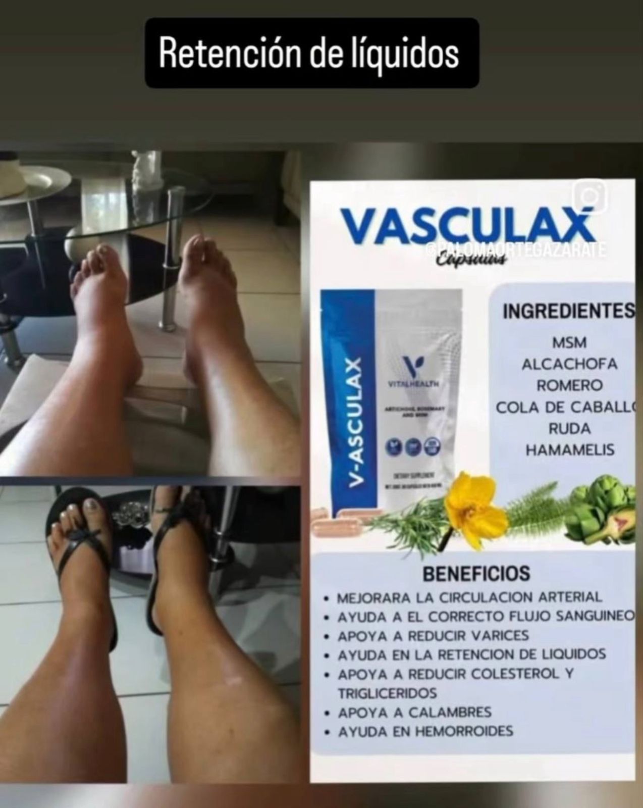 Reducción de retención de líquidos